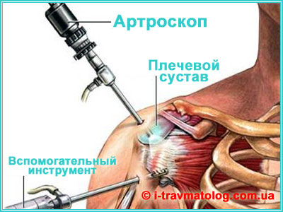 Артроскопия плечевого сустава в Киеве ☎ +38 (063) 310-30-50, Константин Вдовиченко | в клинике №10, ИТО НАМНУ, г. Киев, Украина