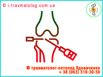 Артроскопия