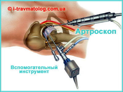 Arthroscopy in Kyiv ☎ +38 (063) 310-30-50, Konstantin Vdovichenko | at Clinic No. 10, ITO NAMS of Ukraine, Kyiv, Ukraine
