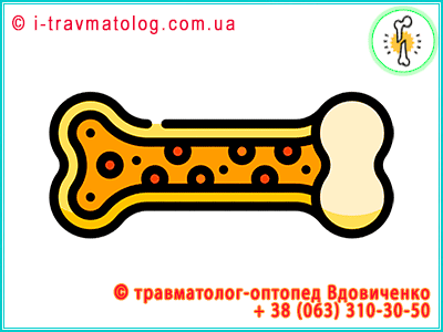 Osteosynthesis for joints in Kyiv ☎ +38 (063) 310-30-50, Konstantin Vdovichenko | at Clinic No. 10, ITO NAMS of Ukraine, Kyiv, Ukraine